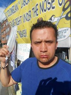 A GM worker on hunger strike in Colombia with his mouth sewn shut.