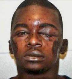 Joshua Robinson after being brutally beaten by police