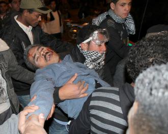 A protester is wounded during protests outside the Interior Ministry following the Port Said massacre (Bora S. Kamel)