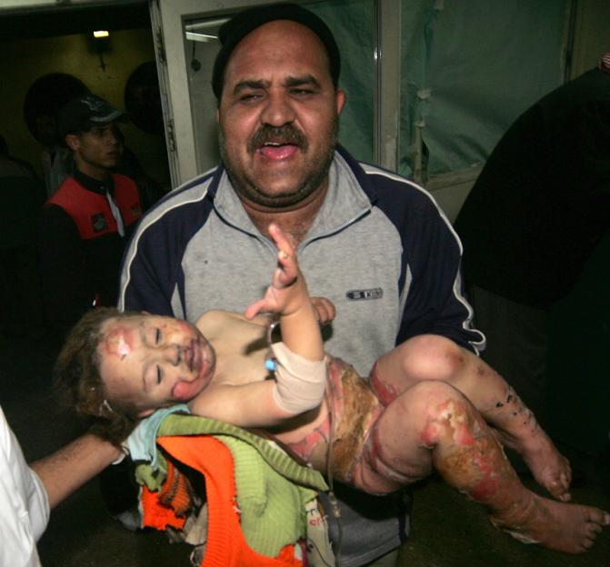 A Palestinian father carries his wounded baby daughter into a hospital in Gaza City