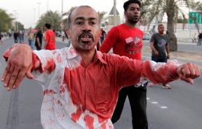 A protester covered in blood from carrying a fellow marcher who was injured in Bahrain