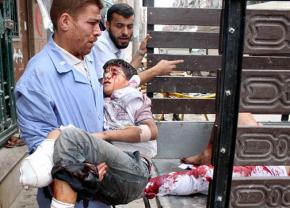 A young boy wounded by Syrian government shelling