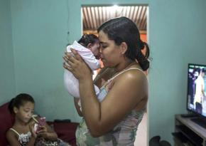 A mother holds her infant born with microcephaly