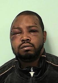 Melvin Jones III after being beaten by Springfield, Mass., police