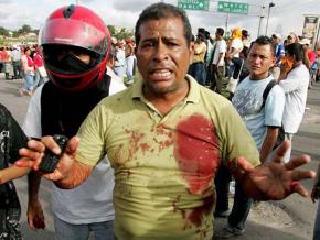 A pro-democracy protester responds to police violence during a demonstration in Tegucigalpa